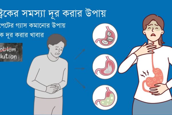 গ্যাস্ট্রিক দূর করার উপায়