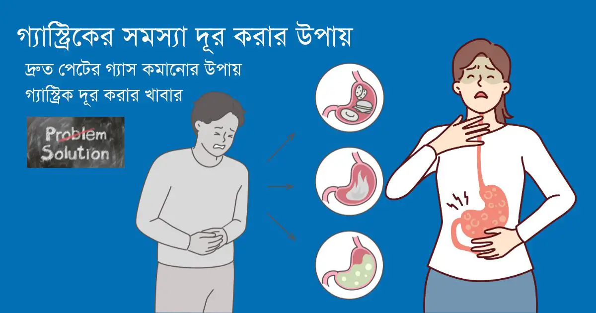 গ্যাস্ট্রিক দূর করার উপায়